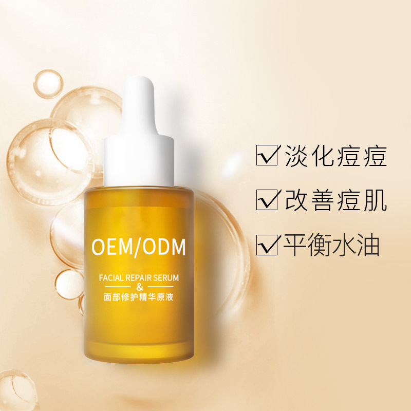 吉林市_祛痘精华原液OEM